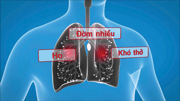 triệu chứng viêm phế quản